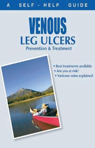 Cover image for The Doctor's Guide to: Venous Leg Ulcers: Prevention and Treatment