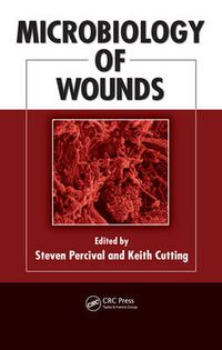 Cover image for Microbiology of Wounds