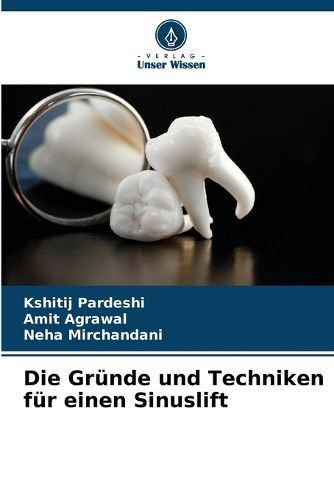 Cover image for Die Gruende und Techniken fuer einen Sinuslift