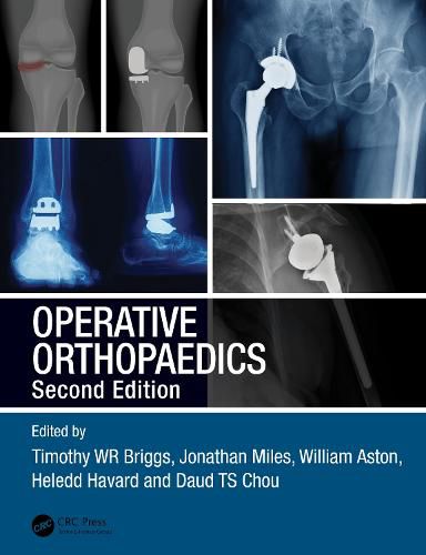 Cover image for Operative Orthopaedics: The Stanmore Guide