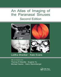 Cover image for Atlas of Imaging of the Paranasal Sinuses, Second Edition