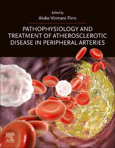 Cover image for Pathophysiology and Treatment of Atherosclerotic Disease in Peripheral Arteries