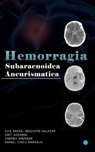 Cover image for Hemorragia Subaracnoidea Aneurismatica