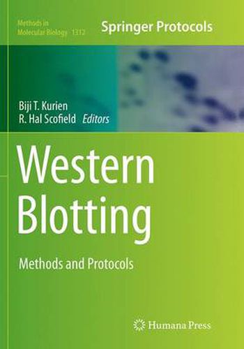 Cover image for Western Blotting: Methods and Protocols