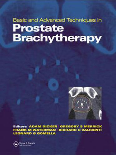 Basic and Advanced Techniques in Prostate Brachytherapy