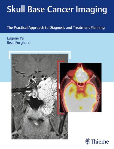 Cover image for Skull Base Cancer Imaging: The Practical Approach to Diagnosis and Treatment Planning