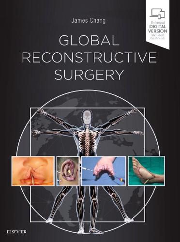 Cover image for Global Reconstructive Surgery