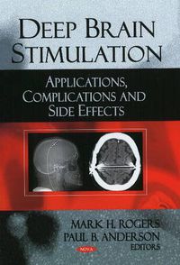 Cover image for Deep Brain Stimulation: Applications, Complications & Side Effects