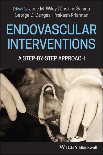 Cover image for Endovascular Procedures A Step-by-Step Approach