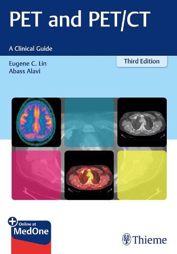 Cover image for PET and PET/CT: A Clinical Guide