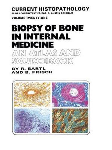 Cover image for Biopsy of Bone in Internal Medicine: An Atlas and Sourcebook