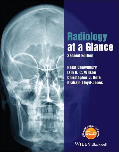 Cover image for Radiology at a Glance 2e