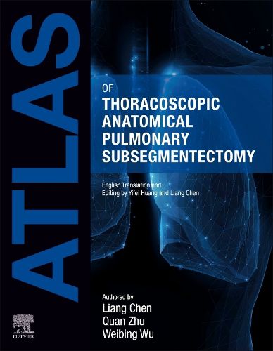 Cover image for Atlas of Thoracoscopic Anatomical Pulmonary Subsegmentectomy