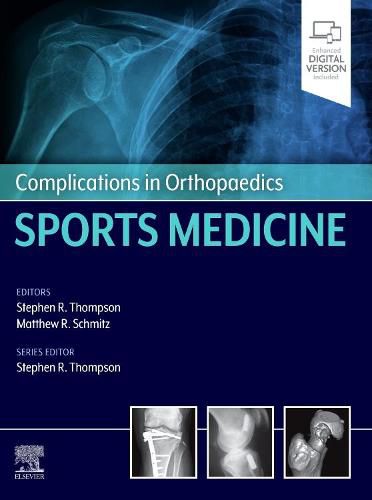 Complications in Orthopaedics: Sports Medicine