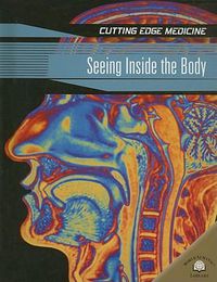 Cover image for Seeing Inside the Body