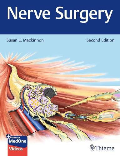 Cover image for Nerve Surgery