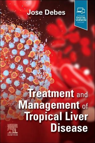 Cover image for Treatment and Management of Tropical Liver Disease