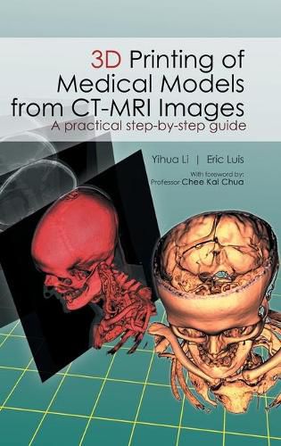 Cover image for 3D Printing of Medical Models from CT-MRI Images: A Practical step-by-step guide