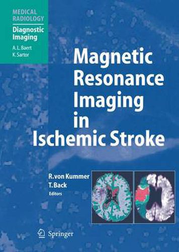Cover image for Magnetic Resonance Imaging in Ischemic Stroke