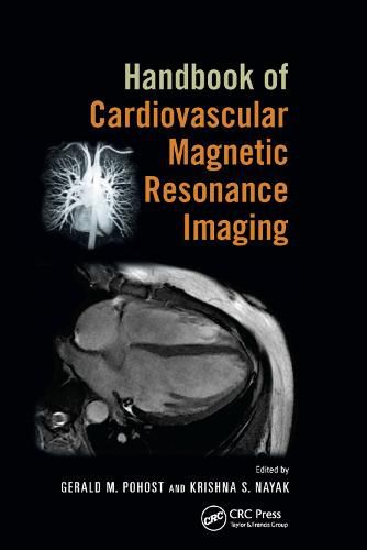 Cover image for Handbook of Cardiovascular Magnetic Resonance Imaging