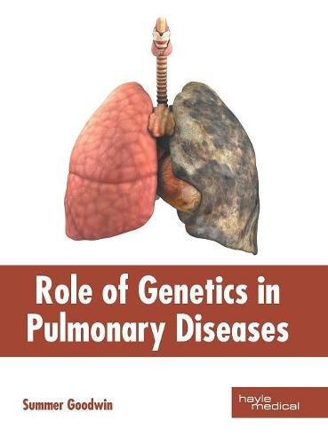 Cover image for Role of Genetics in Pulmonary Diseases