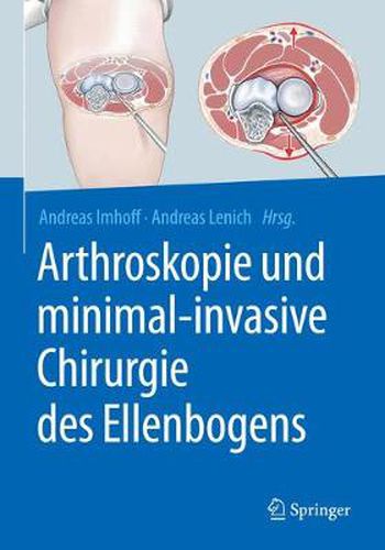 Cover image for Arthroskopie Und Minimal-Invasive Chirurgie Des Ellenbogens