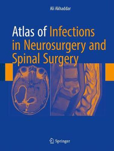 Cover image for Atlas of Infections in Neurosurgery and Spinal Surgery