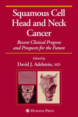 Cover image for Squamous Cell Head and Neck Cancer: Recent Clinical Progress and Prospects for the Future