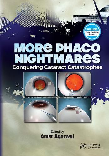 Cover image for More Phaco Nightmares: Conquering Cataract Catastrophes