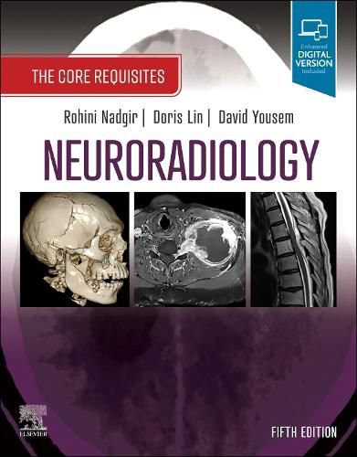 Cover image for Neuroradiology