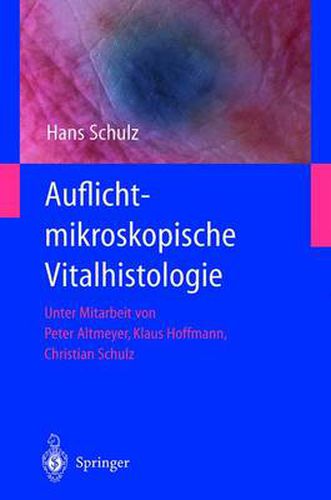 Auflichtmikroskopische Vitalhistologie: Dermatologischer Leitfaden