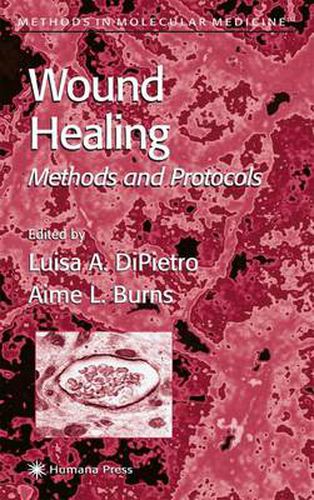 Cover image for Wound Healing: Methods and Protocols