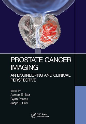 Cover image for Prostate Cancer Imaging