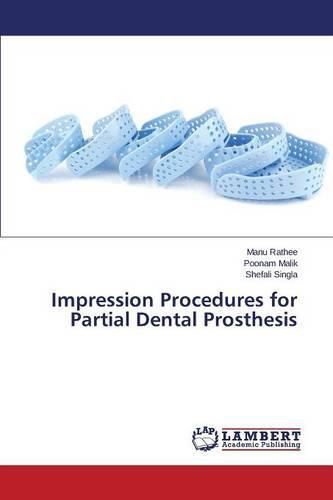 Cover image for Impression Procedures for Partial Dental Prosthesis