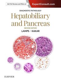 Cover image for Diagnostic Pathology: Hepatobiliary and Pancreas