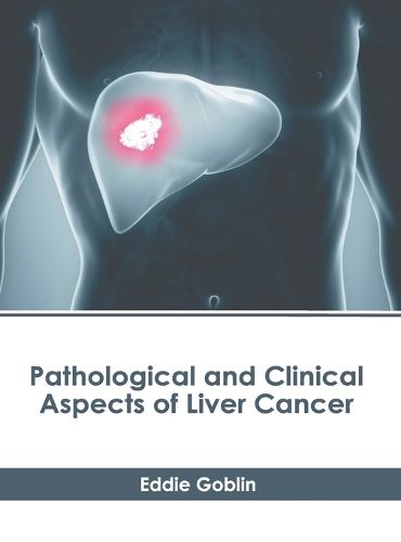 Cover image for Pathological and Clinical Aspects of Liver Cancer