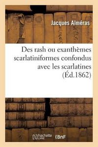 Cover image for Des Rash Ou Exanthemes Scarlatiniformes Confondus Avec Les Scarlatines