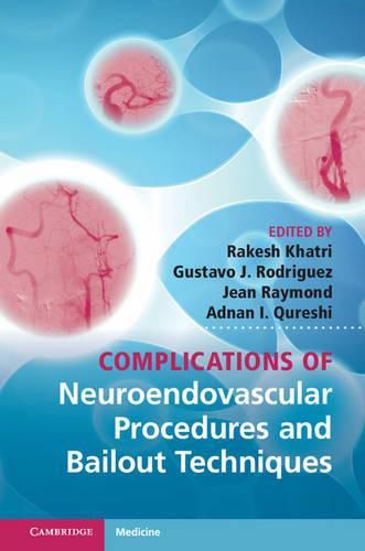 Cover image for Complications of Neuroendovascular Procedures and Bailout Techniques