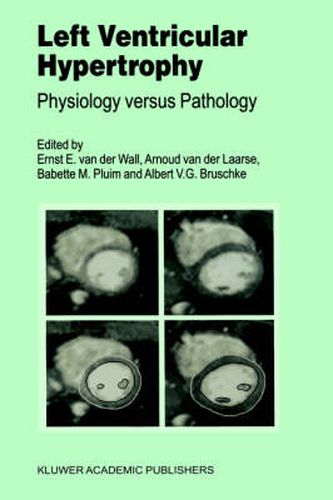 Left Ventricular Hypertrophy: Physiology versus Pathology