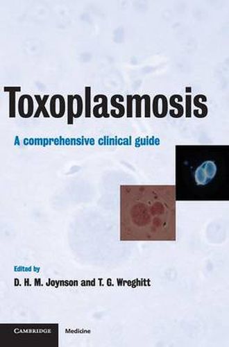 Toxoplasmosis: A Comprehensive Clinical Guide