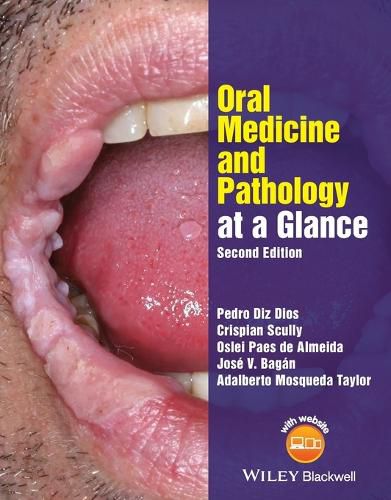 Oral Medicine and Pathology at a Glance 2e