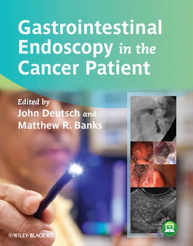 Cover image for Gastrointestinal Endoscopy in the Cancer Patient