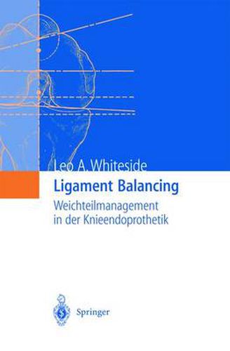 Cover image for Ligament Balancing: Weichteilmanagement in der Knieendoprothetik