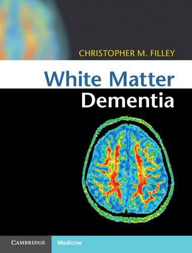 Cover image for White Matter Dementia