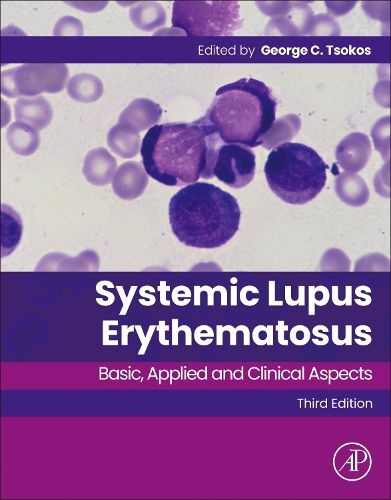 Cover image for Systemic Lupus Erythematosus