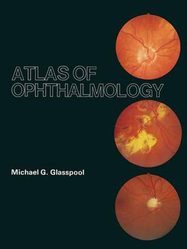 Cover image for Atlas of Ophthalmology