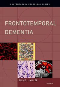 Cover image for Frontotemporal Dementia