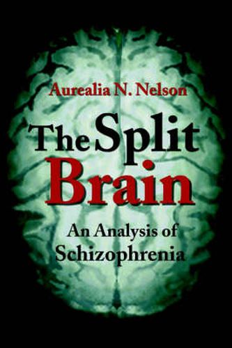 Cover image for The Split Brain: An Analysis of Schizophrenia