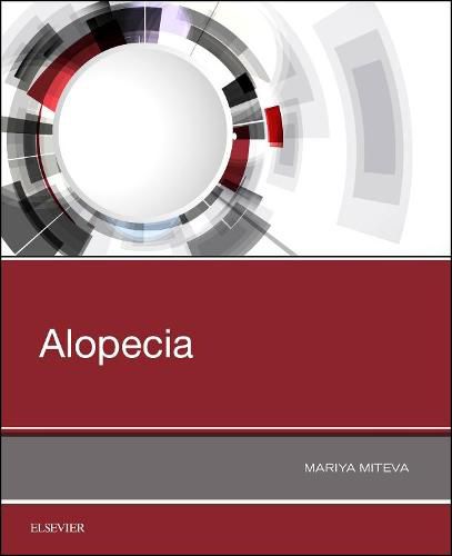 Cover image for Alopecia