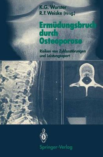 Cover image for Ermudungsbruch Durch Osteoporose